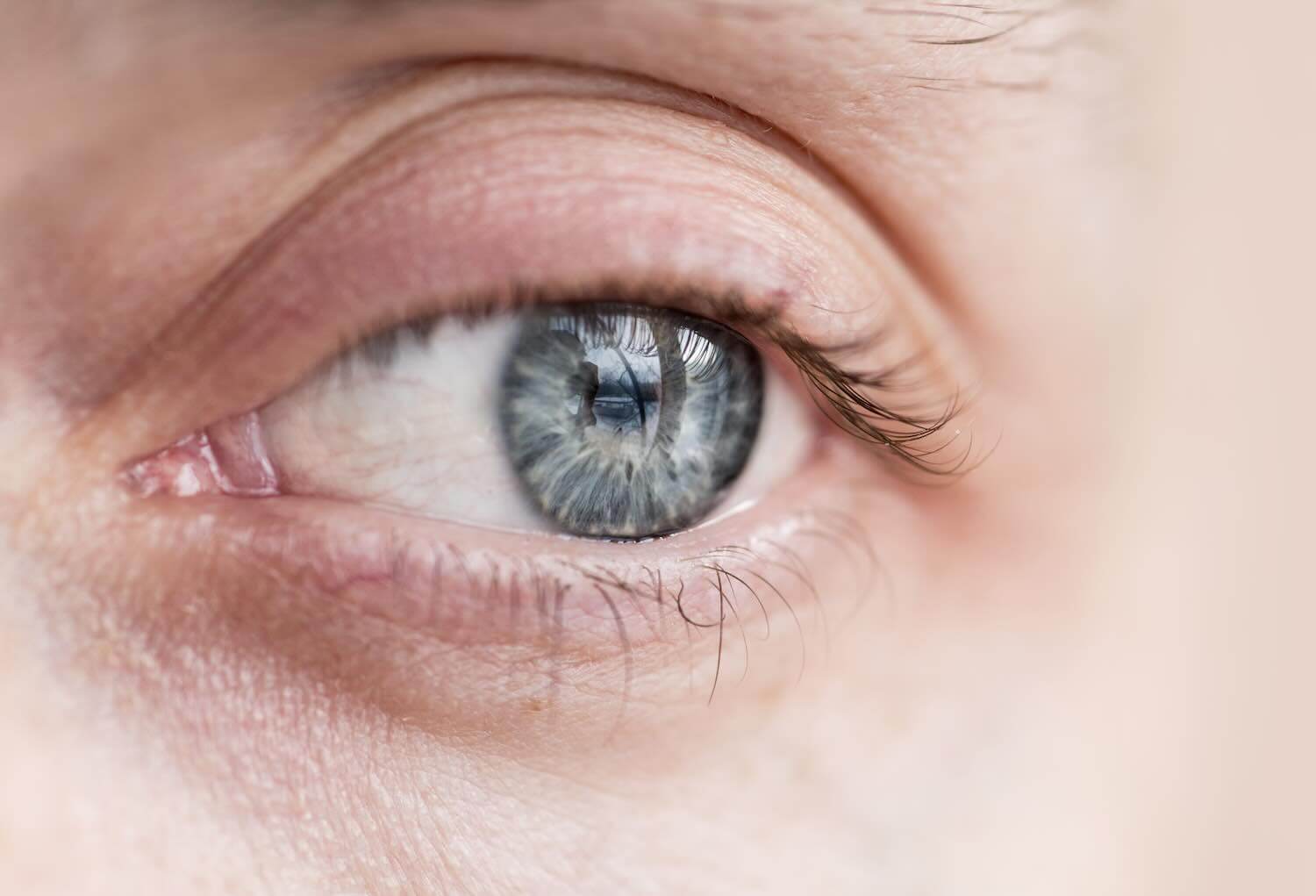 Pucker maculare: sintomi, diagnosi OCT e trattamento chirurgico con vitrectomia Membrana epiretinica: cos’è il pucker maculare e come si cura con la microchirurgia