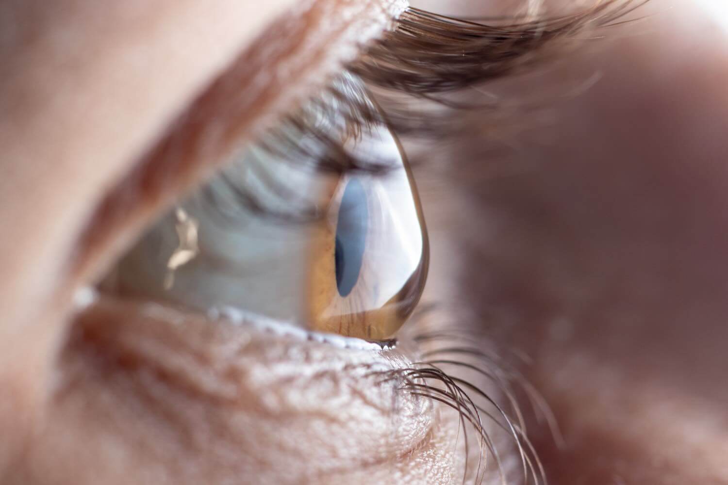 chirurgia-cornea